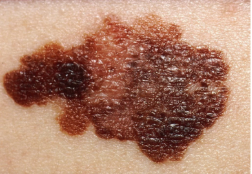 A close-up of a skin with a few brown spotsAI-generated content may be incorrect.